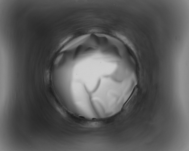 X0000086110057200704132218