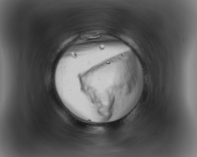 X0000086110159200704132217