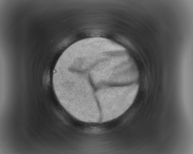 X0000086110310200704132215