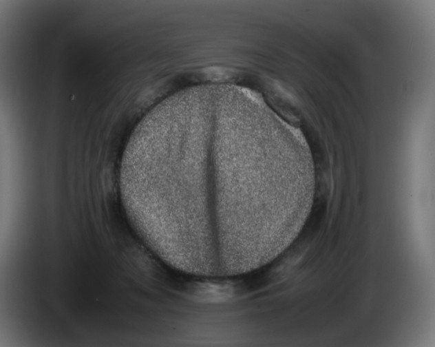 X0000086110317200704132215