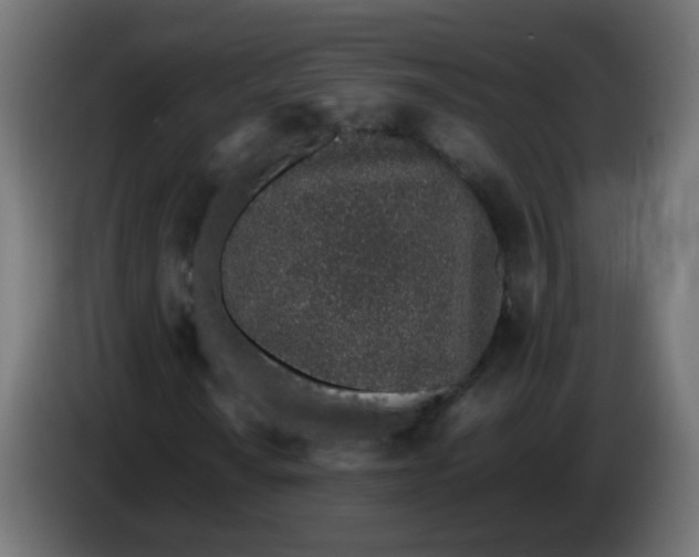 X0000086111010200704132204