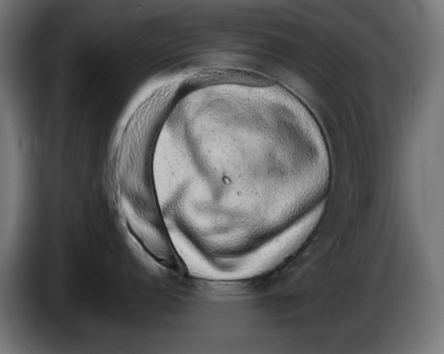 X0000086111152200704132203