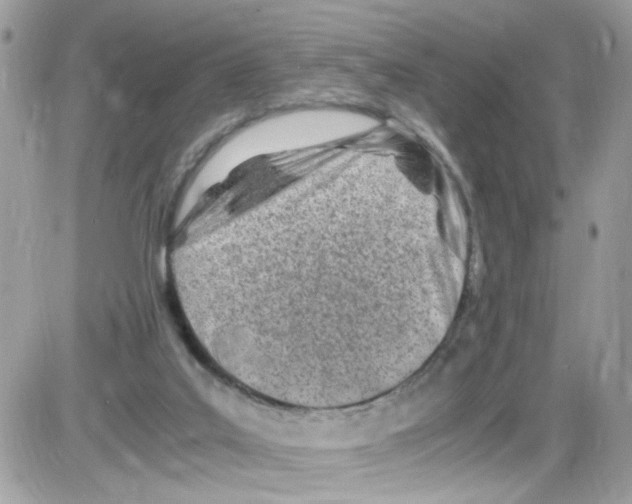 X0000086110019200704202317