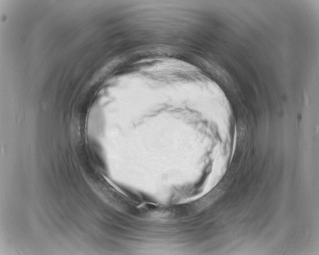 X0000086110158200704202314