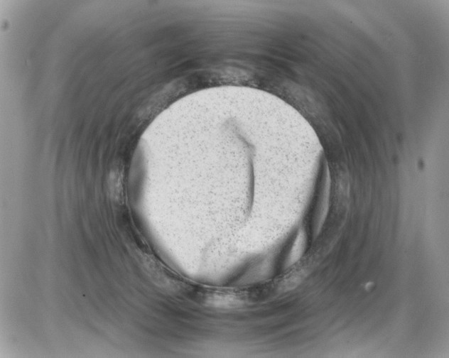 X0000086110177200704202315