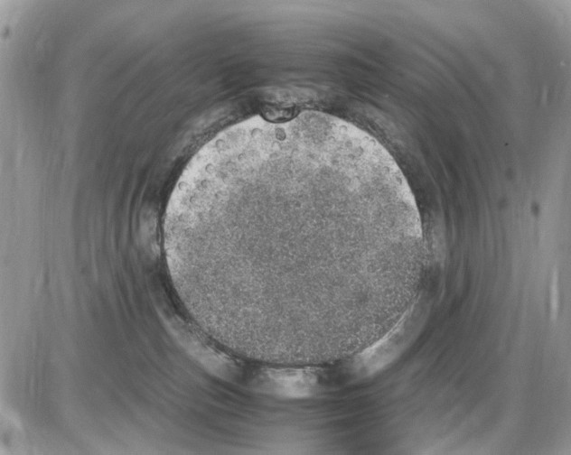 X0000086110187200704202315