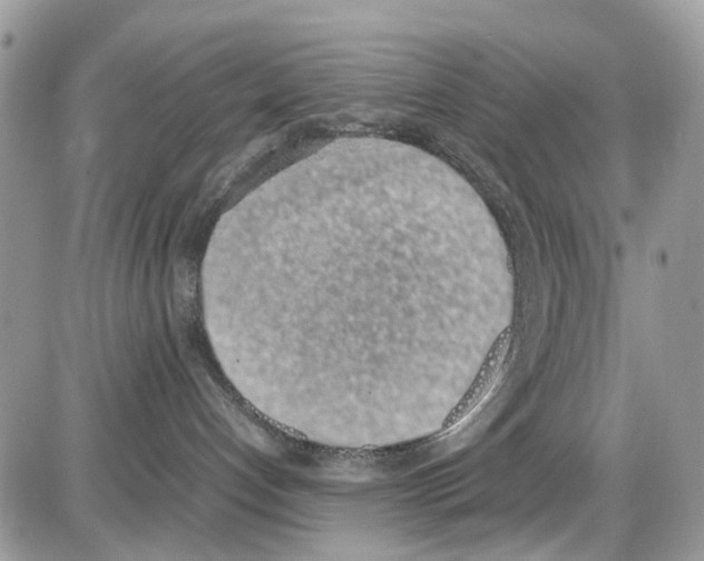 X0000086110192200704202315