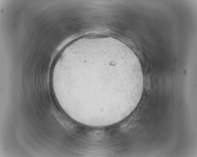 X0000086110196200704202314