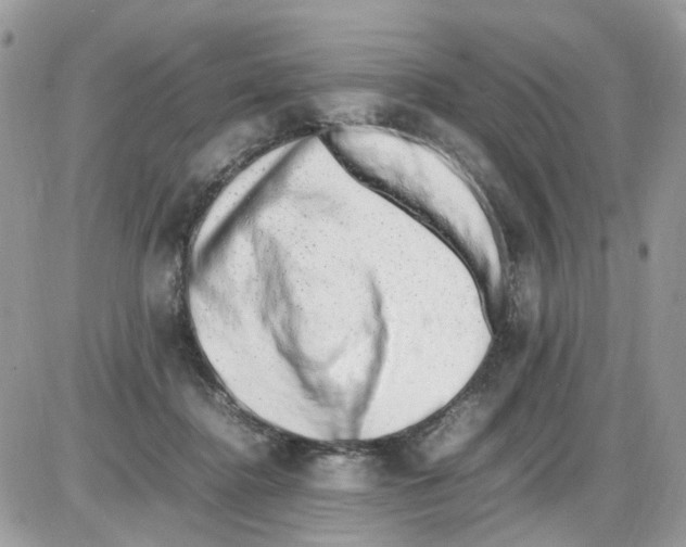 X0000086110364200704202311