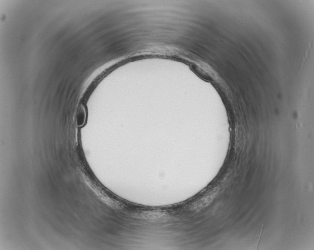 X0000086110838200704202304