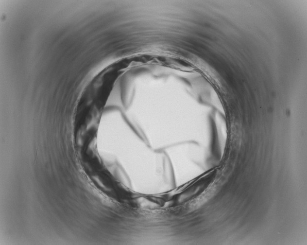 X0000086110854200704202304