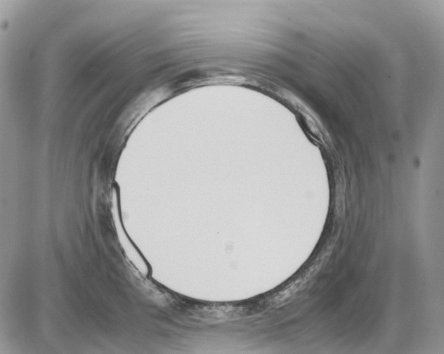 X0000086111193200704202258