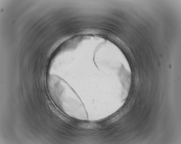 X0000086111417200704202254