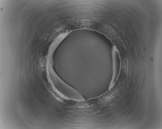X0000086220818200703291209