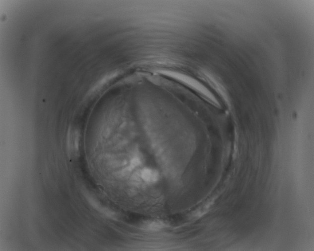 X0000086220115200704051250