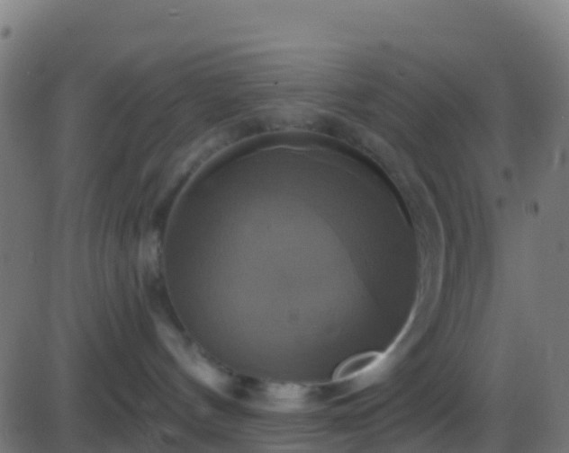 X0000086220144200704051250