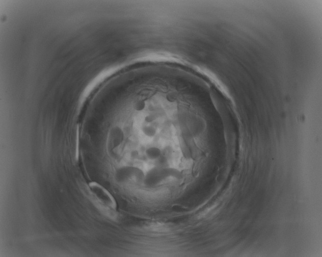 X0000086221175200704051232