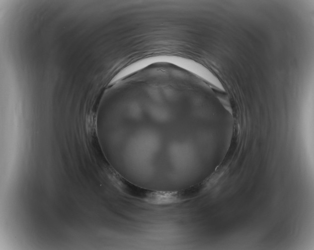 X0000086220093200704121905