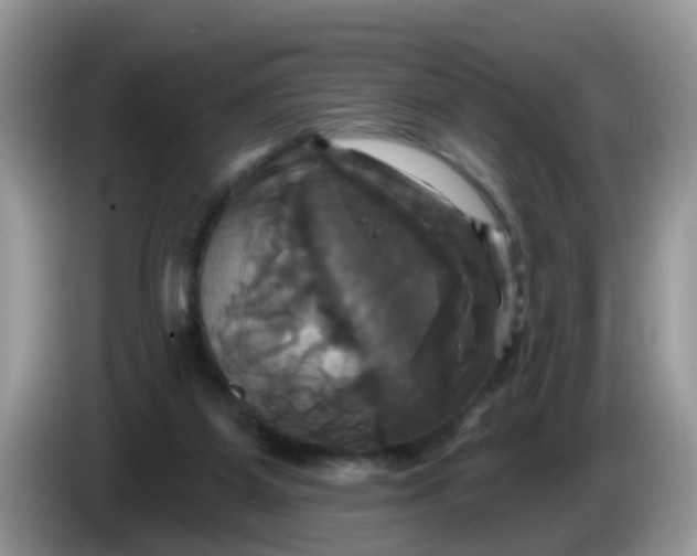 X0000086220115200704121904