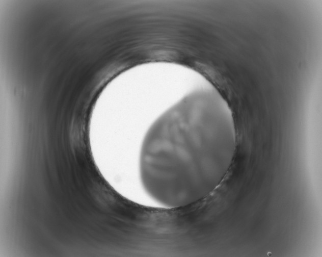 X0000086220146200704121903