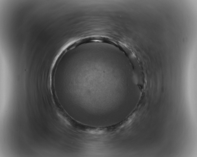 X0000086220148200704121903