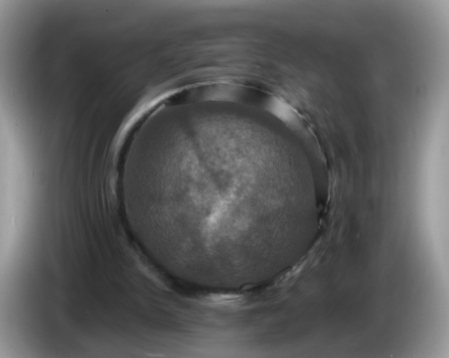 X0000086220150200704121903