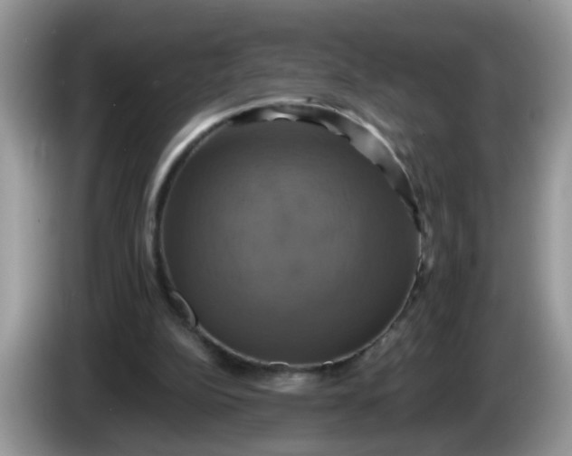 X0000086220152200704121903