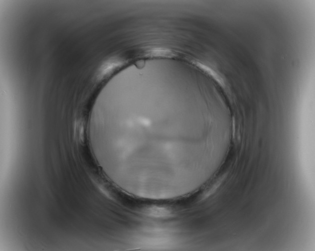 X0000086220157200704121903