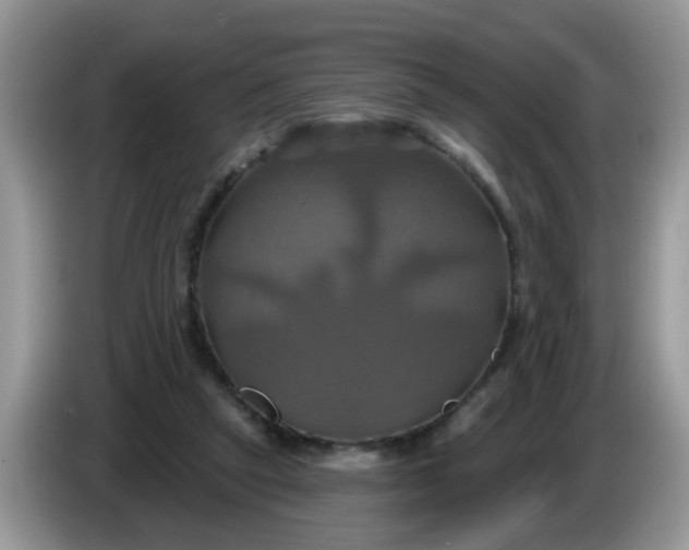 X0000086220257200704121902