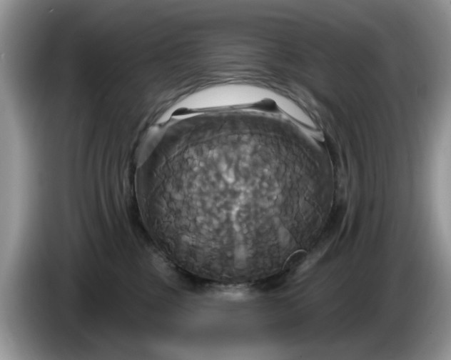 X0000086220377200704121901