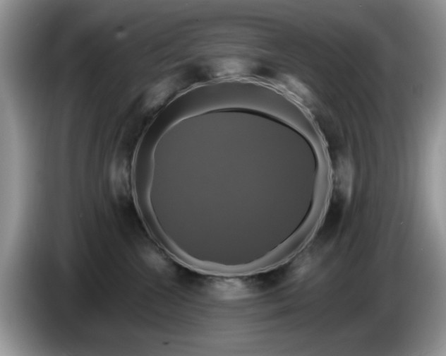 X0000086220572200704121859