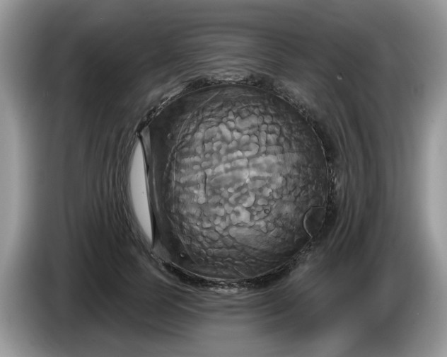 X0000086220745200704121857