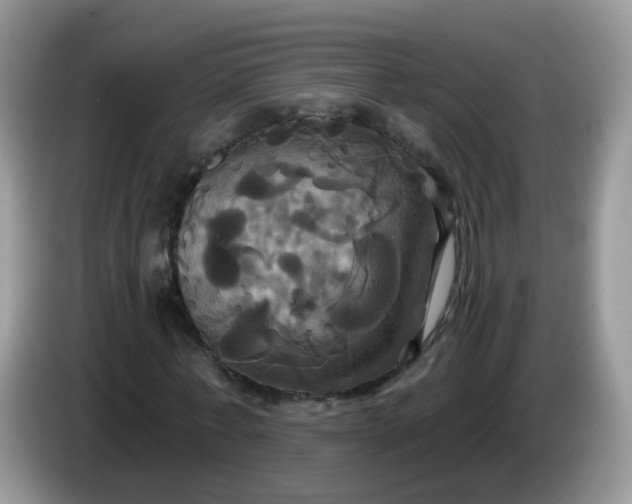 X0000086220771200704121856