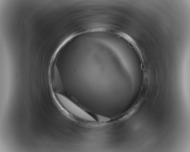 X0000086220859200704121856