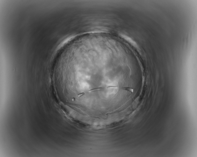 X0000086221407200704121848