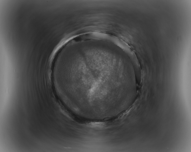 X0000086220150200704191745