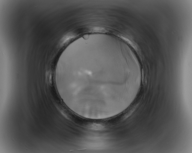 X0000086220157200704191746