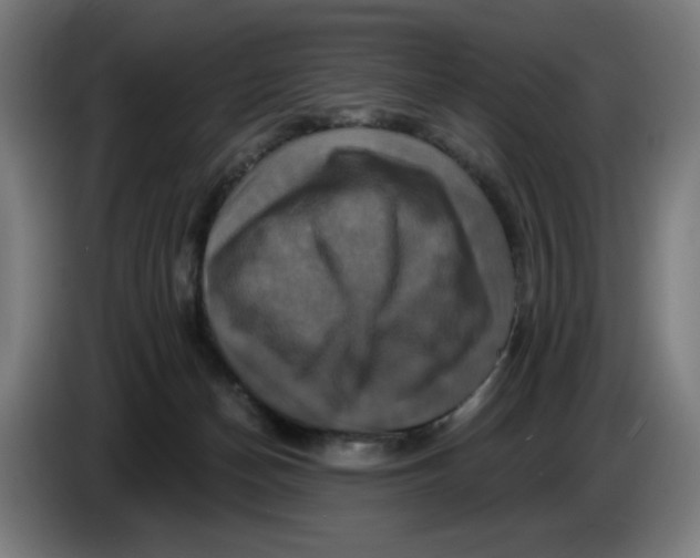 X0000086220174200704191746