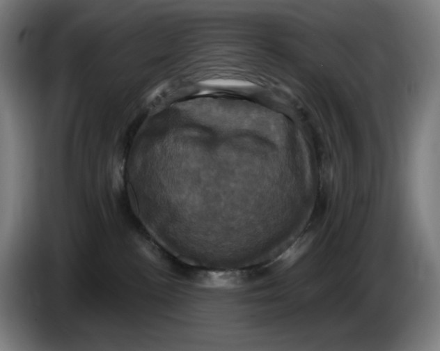 X0000086220188200704191746