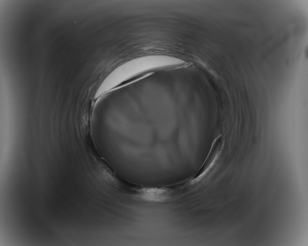 X0000086220192200704191746