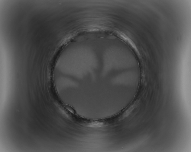 X0000086220257200704191744