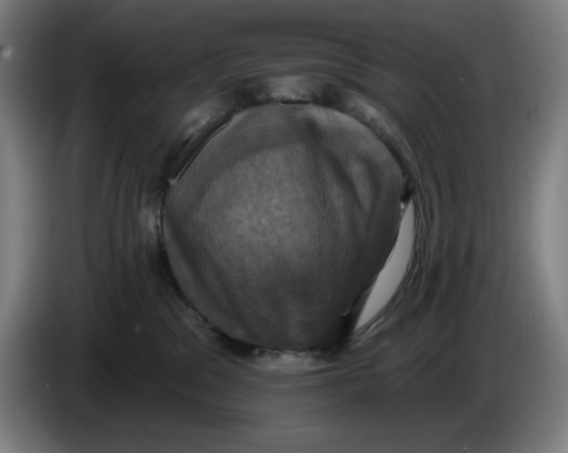 X0000086220329200704191744