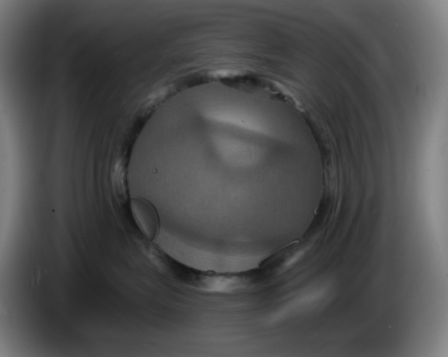 X0000086220575200704191741