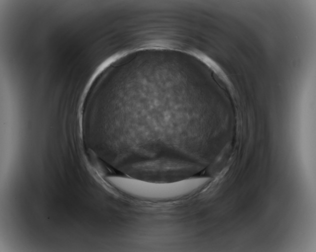 X0000086221238200704191731