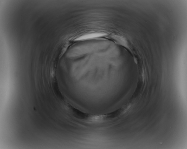 X0000086220084200704261845