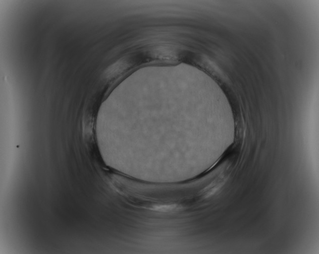 X0000086220141200704261844