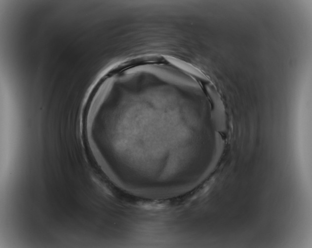 X0000086220148200704261843