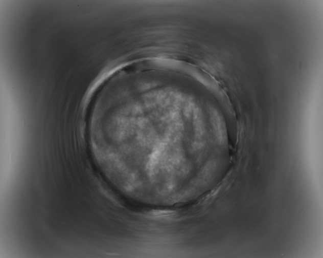 X0000086220150200704261843