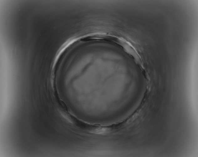 X0000086220152200704261843