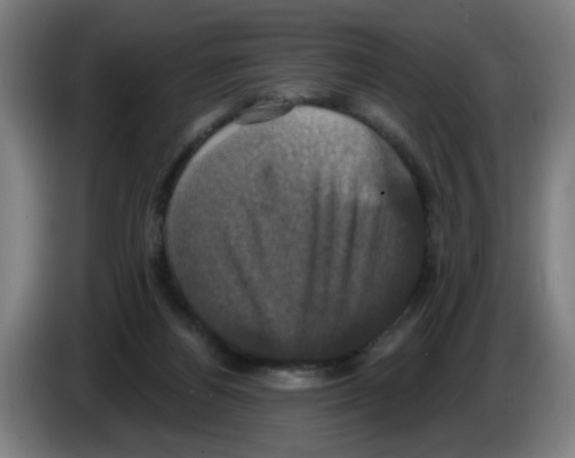 X0000086220164200704261843